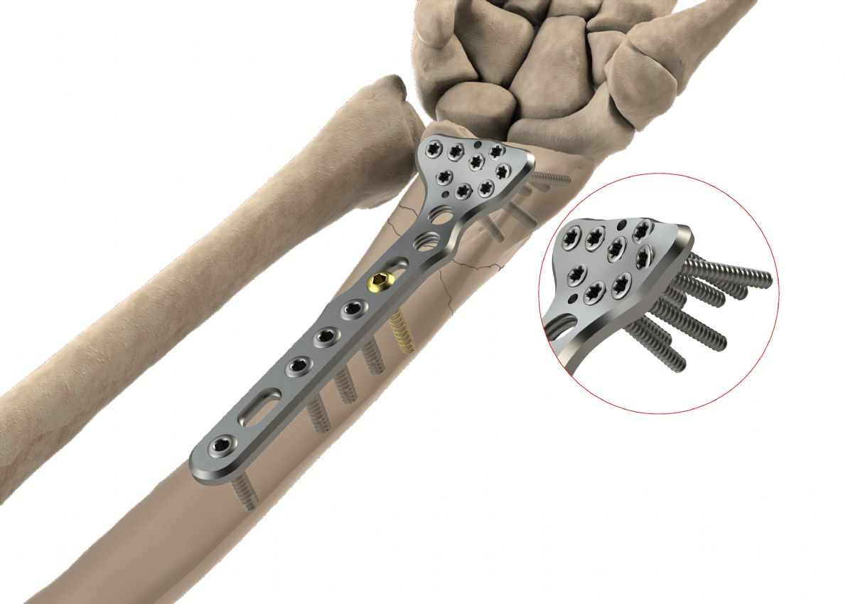 Turkiye, Medical and Health Products, Medical Devices and Equipment, Rehabilitation Products, Natural Health and Wellness Products