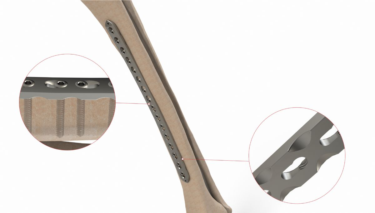 Turkiye, Medical and Health Products, Medical Devices and Equipment, Rehabilitation Products, Natural Health and Wellness Products